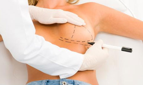 breast_surgery