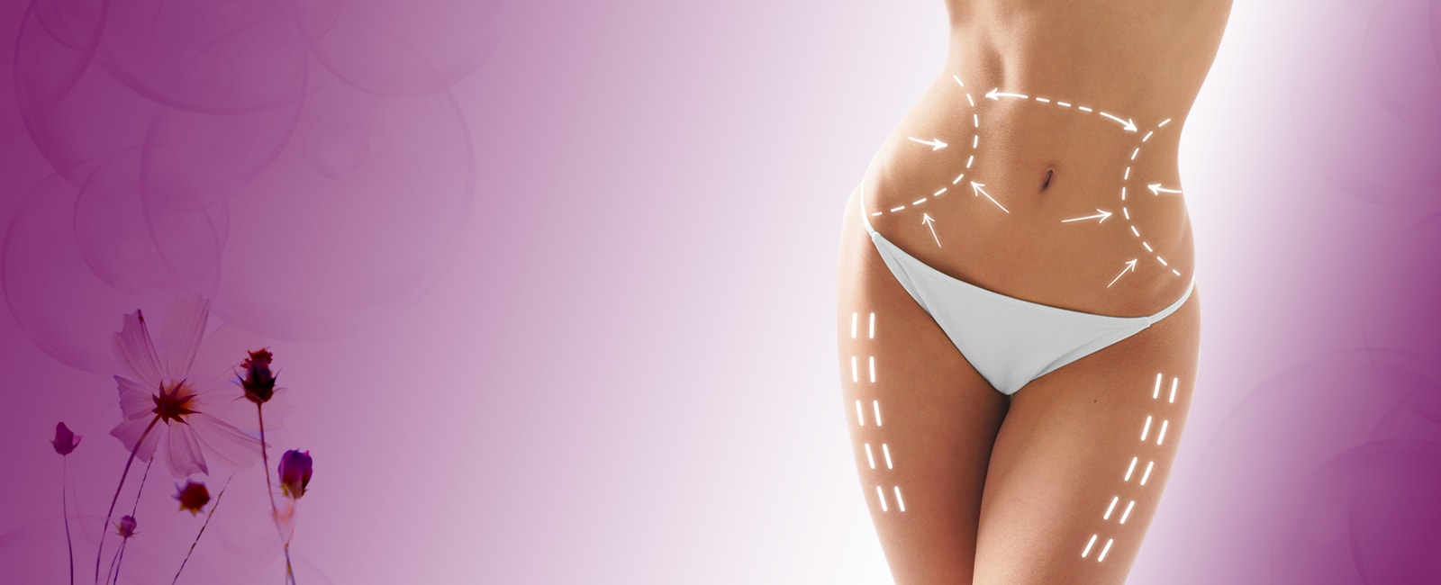 liposuction